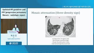 제25차 서울아산병원 호흡기내과 연수강좌 : Severe and intractable respiratory disease : Updated IPF guideline and PPF (progressive pulmonary fibrosis : radiologic aspect 미리보기