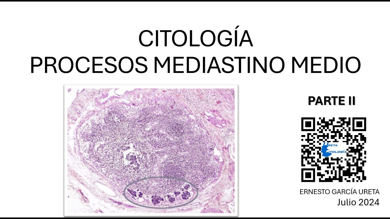 Citología de “Mediastino Medio” Parte II.