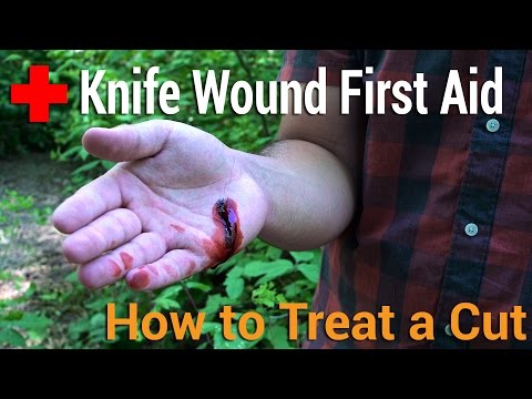 How to Treat a Cut | Knife Wound First Aid