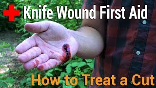 How to Treat a Cut  Knife Wound First Aid