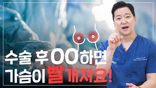 가슴수술 사후관리-생활편 (1개월~6개월)