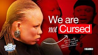 What It’s REALLY Like Living With Albinism in Nigeria | The Honest Bun