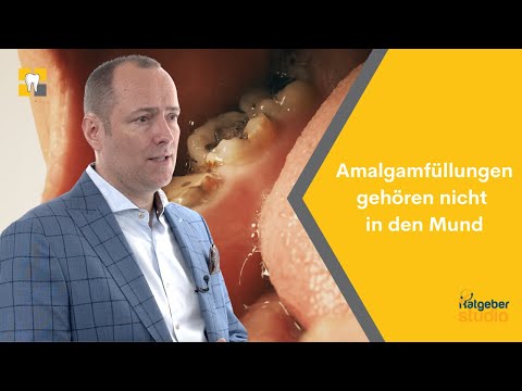 Amalgam – welche Auswirkungen haben Amalgamfüllungen auf unsere Gesundheit?
