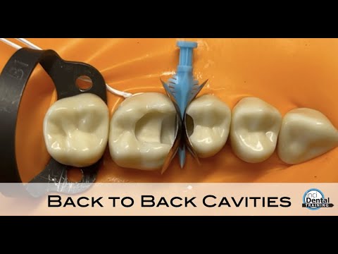 Back to Back Cavity Tutorial