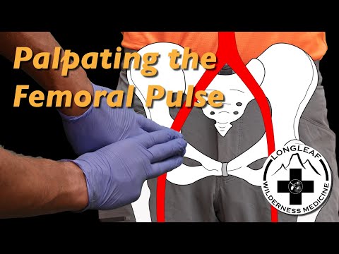 Palpating the Femoral Pulse