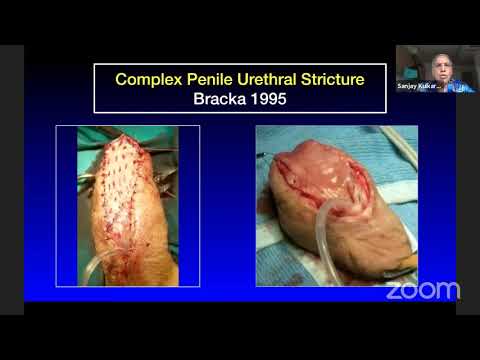 I SEE U - IUA Webinar "Genitourinary Reconstructive and Trauma in Urology"