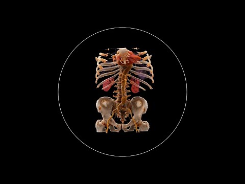 What is Computed Tomography (CT) and how does it work?