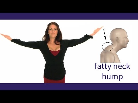 How to Get Rid of a Neck Hump (5 Exercises for a Total Posture Makeover)