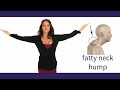 How to Get Rid of a Neck Hump (5 Exercises for a Total Posture Makeover)