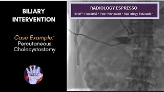 BILIARY INTERVENTION: Case Example - PERCUTANEOUS CHOLECYSTOSTOMY