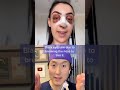 Amazing Nose Job Transformation Shorts