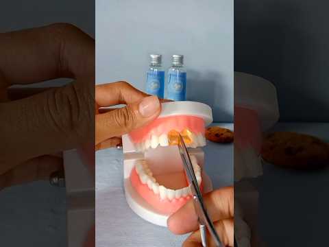 Tooth Repair Kit #shorts #gadgets #teeth #products