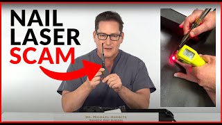 Nail Laser Scams: DIY - Home Fungus Toenail Lasers - Do They Really Work