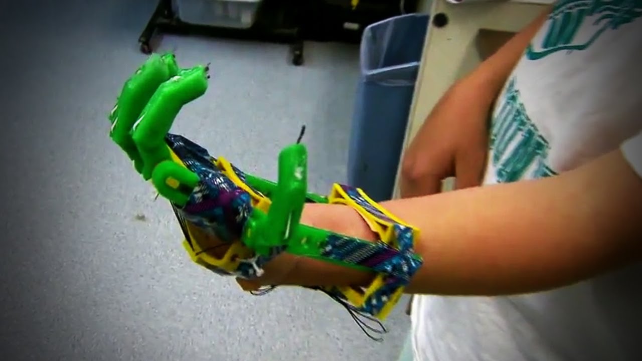Dad Uses 3-D Printer to Make Son New Hand!