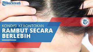 Kebotakan, Kondisi Kerontokan Rambut yang Parah Sebabkan Adanya Bagian Pitak di Kulit Kepala