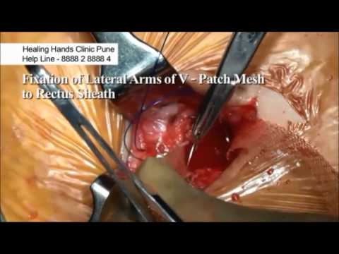 Patient Testimonials