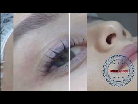 Kiprik Mualicesi, kiprik laminasiyasi, Kiprik botoxu, kiprik qaynagi Ilahe Tehmezli