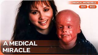 Boy Born with 0% Chance of Survival | Medical Incredible