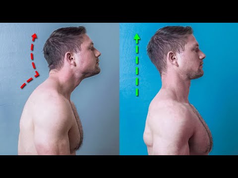 How to Actually FIX Forward Head Posture (The Science-Backed Way)