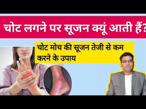 How to Reduce Swelling After an Injury | चोट की सूजन कम करने ले उपाय