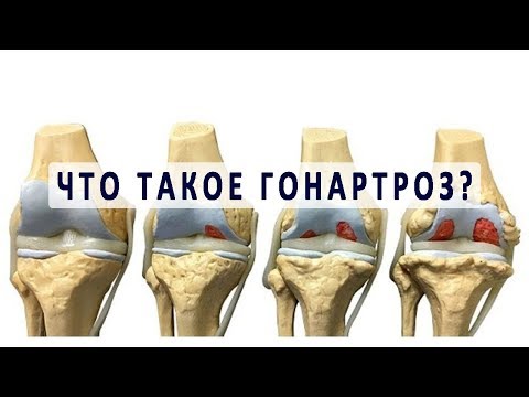 Массаж остеохондроз кривой рог Вывих суставов у собак чем и как лечить