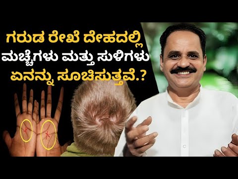 ಗರುಡ ರೇಖೆ ಮಚ್ಚೆ ಸುಳಿಗಳು ಭವಿಷ್ಯವನ್ನ ಹೇಳುತ್ತವೆಯಾ? | Garuda Marks Reveal Your Destiny?