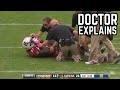 Worst Football Injuries EVER Doctor Explains Marcus Lattimore Knee Dislocation