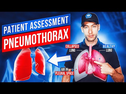 Patient Assessment Trauma | Tension Pneumothorax | EMT Skills | NREMT Review