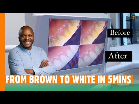 From Brown To White In 5 Minutes #BongaNaJalas