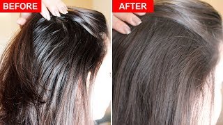 How To Fix Greasy Hair Naturally