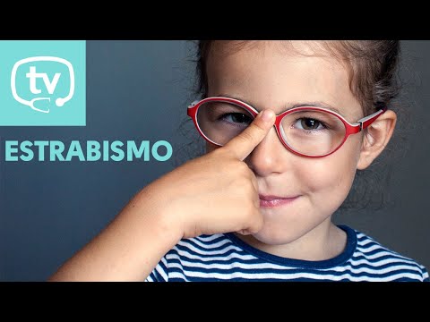 Estrabismo, ¿qué es?