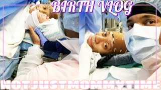 LABOR AND DELVERY // REPEAT SCHEDULED C-SECTION