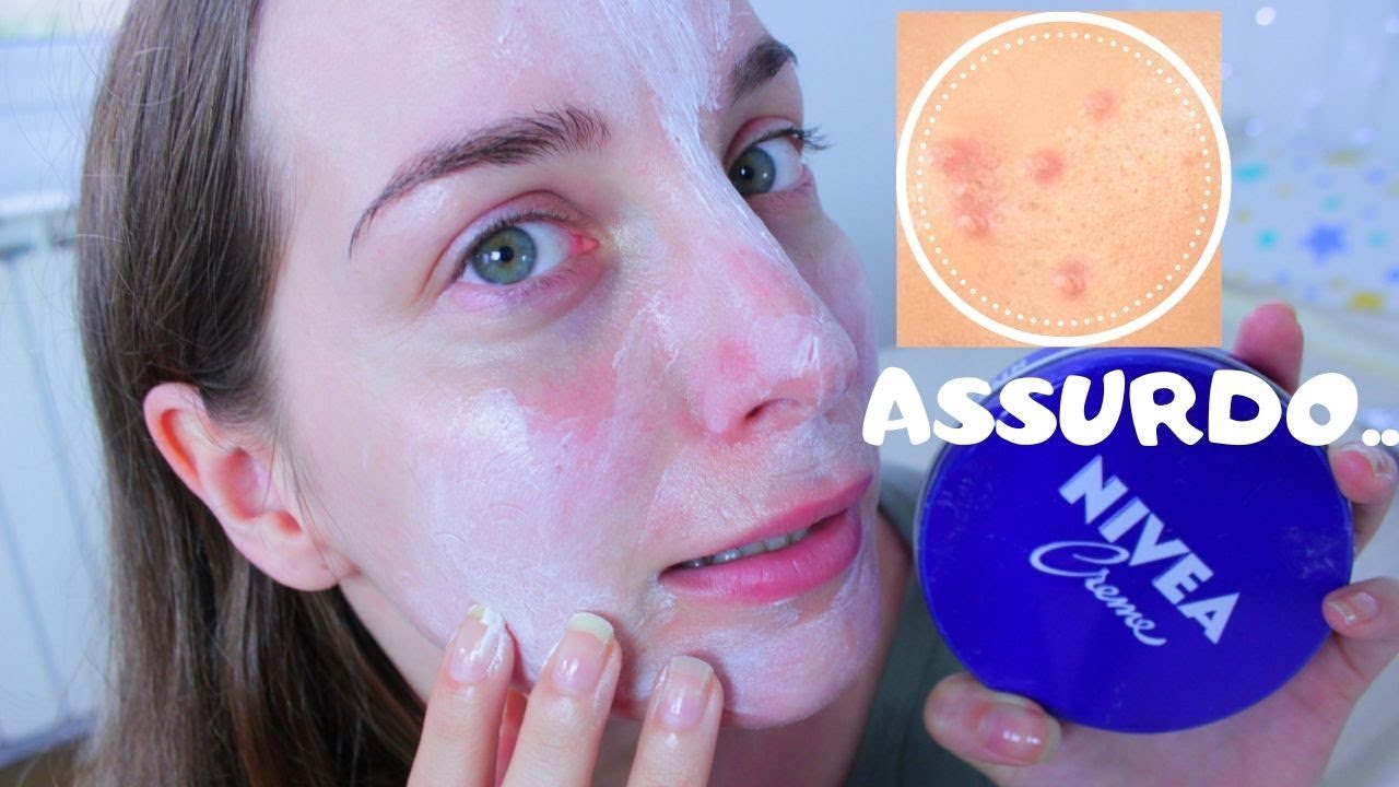 Watch Now Ho usato la famigerata NIVEA CREME sulla mia pelle per una settimana Ho usato la famigerata NIVEA CREME sulla mia pelle per una settimana