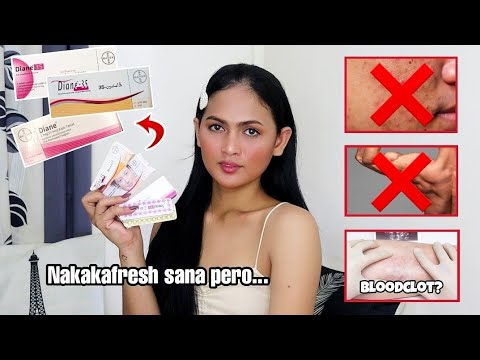 USAP TAYO ABOUT DIANE 35 GERMANY, THAI AT TURKEY. ANO ANG MAS EFFECTIVE? ALAMIN! | Mariel Japitan