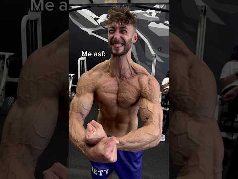 MOST INSANE VEINS YOU’LL EVER SEE