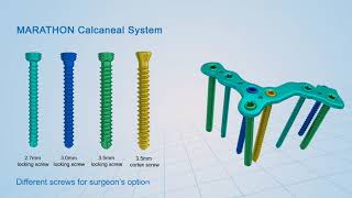 Download lagu Sistem Kalkaneal MARATHON Medis Ganda mp3