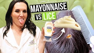 Removing LICE with MAYONNAISE!!? Watch this before you try!