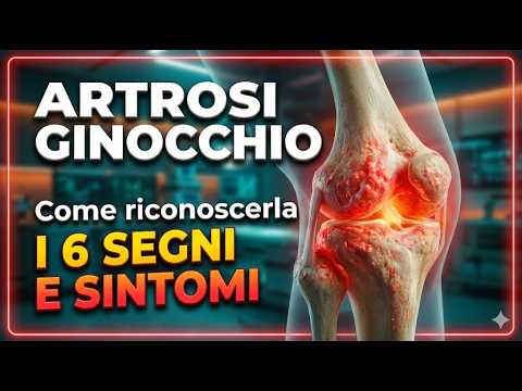 Knee Osteoarthritis: How to Recognize It | 6 Signs and Symptoms You Should Watch Out For