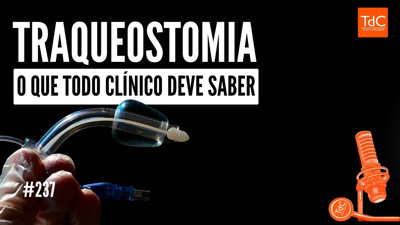 Episódio 237: TRAQUEOSTOMIA - o que todo clínico precisa saber