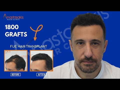 Αποτέλεσμα με 1800 FUs – Repair Case