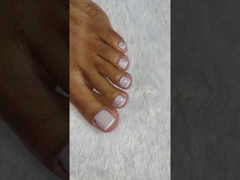 Resultado maravilhoso.