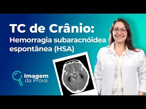 Imagem da Prova: TC de Crânio | Radiografia | Medway