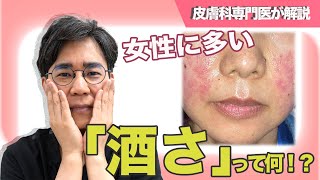 女性に多い「酒さ」って何！？