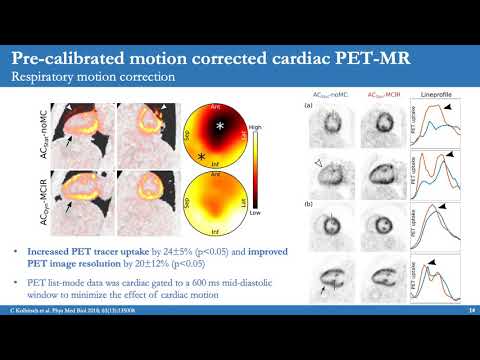 ISMRM MR Academy - PET/MR