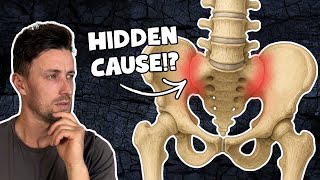 Treat the HIDDEN Cause of Your SIJ Pain