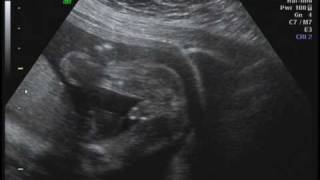 Cameron's pride and joy