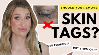 How to Actually Fix Skin Tags | Dr. Sam Ellis