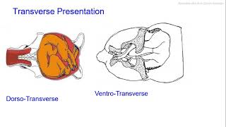 Download Lagu Causes of Dystocia | Why There is Difficult Birth in Animals | Veterinary Obstetrics Thumbnail