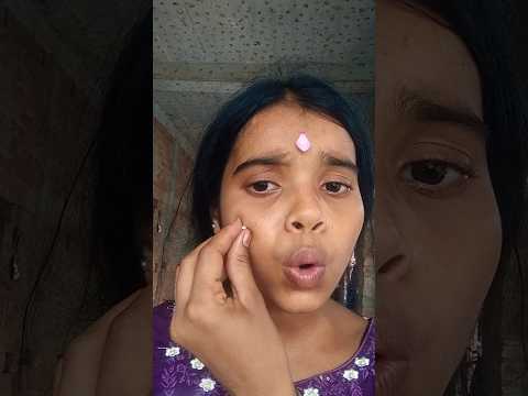 What ah oh with jelly eyball #funny #comedy #funnyfamily #shorts #8767887