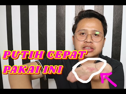 cara-memutihkan-badan-yang-belang-akibat-sinar-matahari